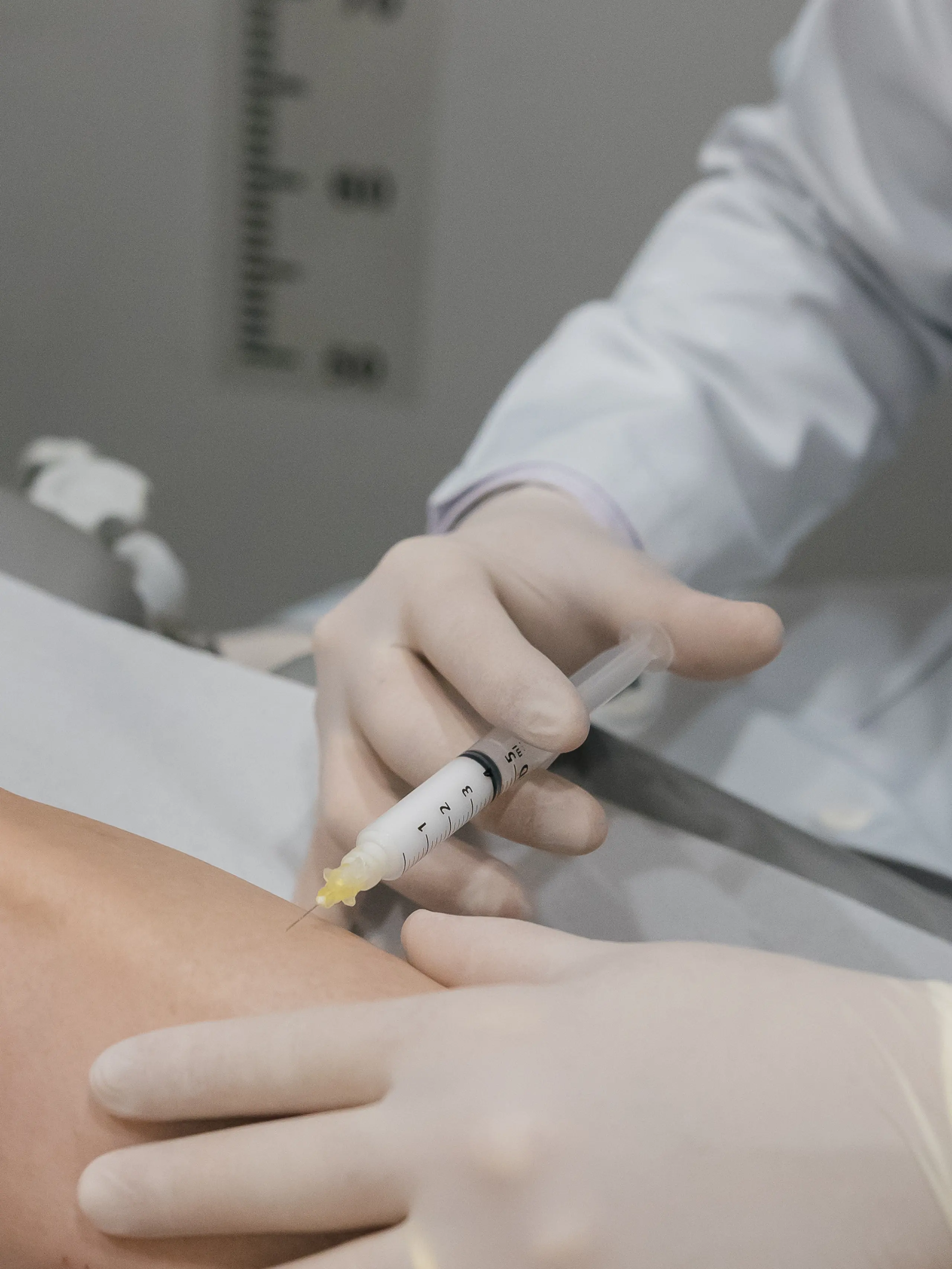 Dr. Lucas Cartafina aplicando escleroterapia com espuma densa em veia da perna do paciente